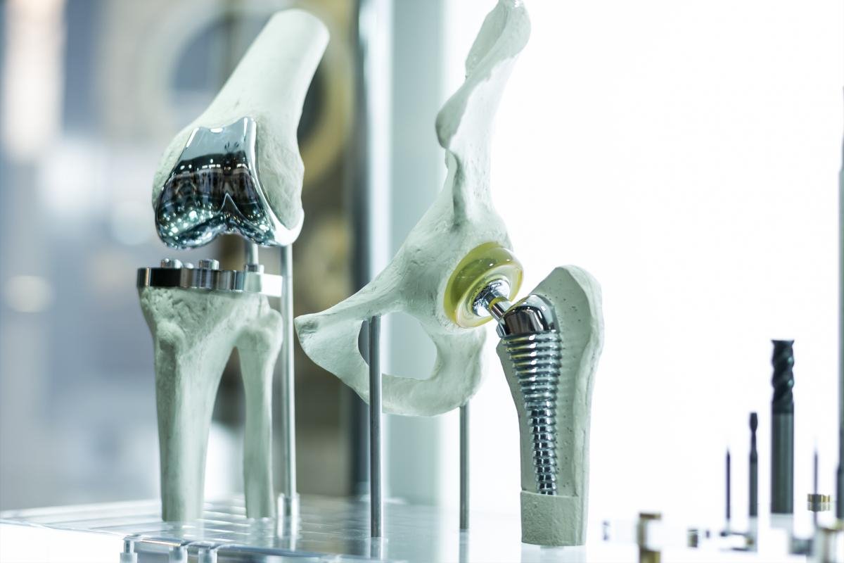 Artificial knee and hip implants used to replace natural joints in patients with severe osteoarthritis