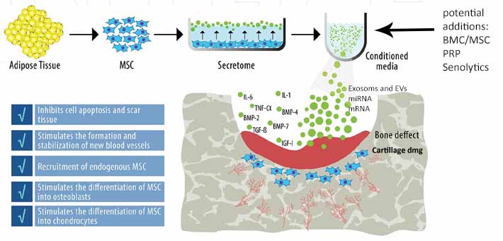 Anova Stem Cell Exosome EV apraoch