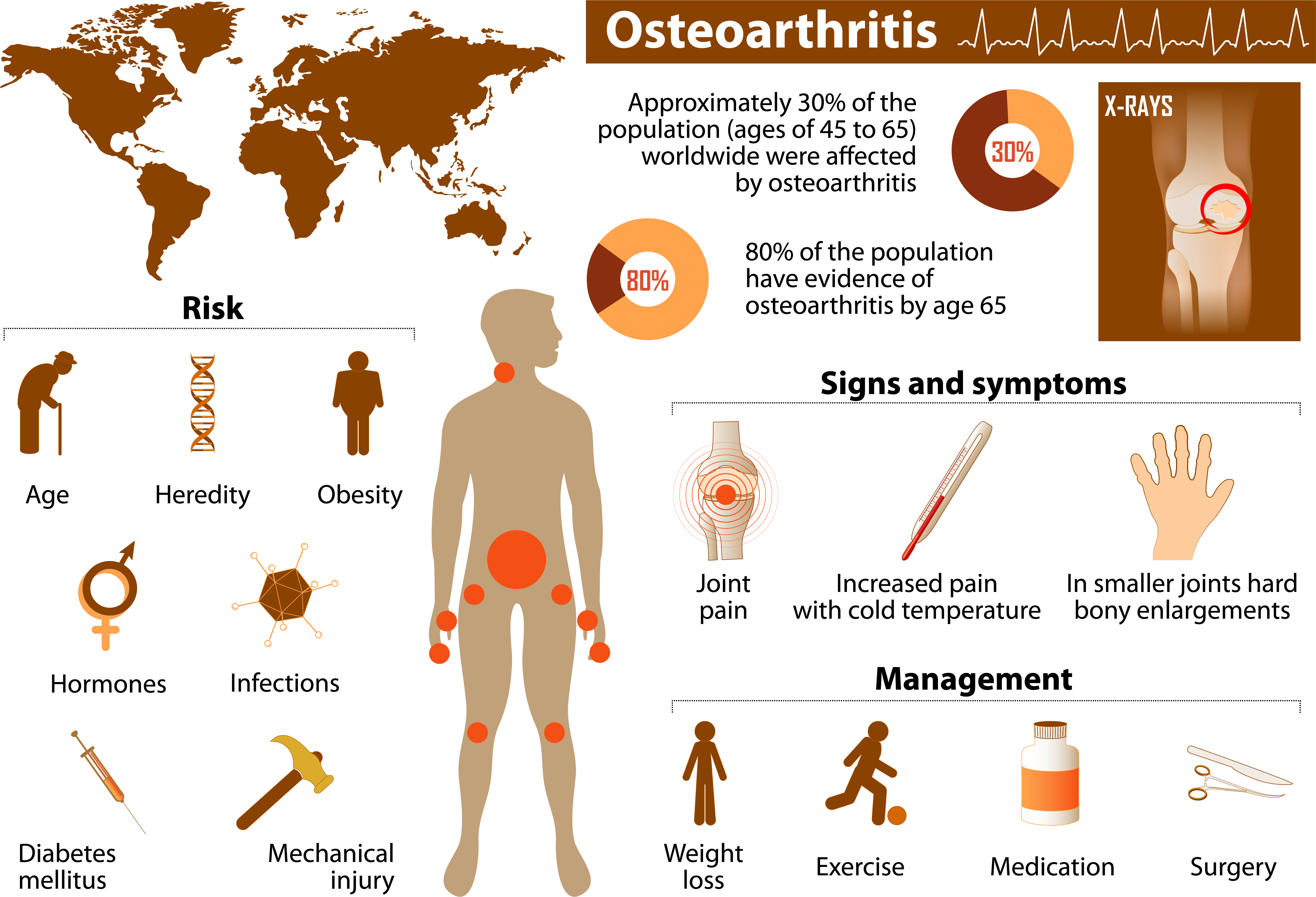 Osteoarthritis Statistic