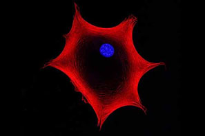 anova institute for regenerative medicine MSC adMSC mesenchymal stem cells