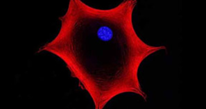 ANOVA Institute for Regenerative Medicine - MSC Msenchymal Stem Cells