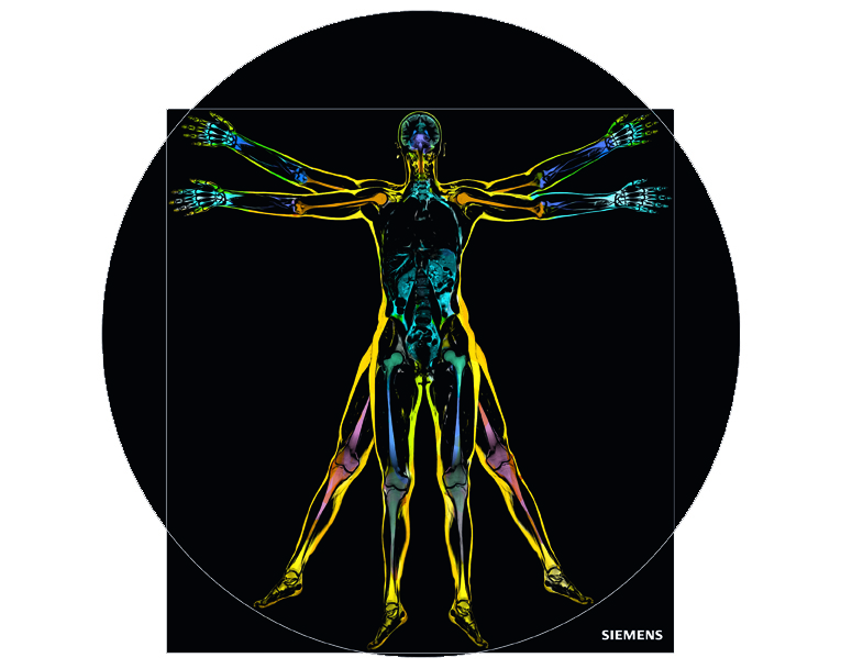 Whole-body MRI scan for the early detection of disease at the Institut für Bildgebende Diagnostik in Offenbach, Germany.