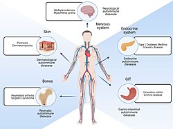 Diagram showing autoimmune diseases affecting multiple organs due to immune dysregulation relevant to stem cell therapy for autoimmune diseases