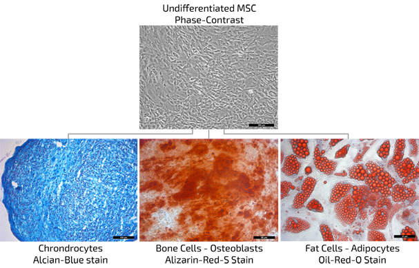 ANOVA IRM Germany MSC mesenchymal stem cell differentiation