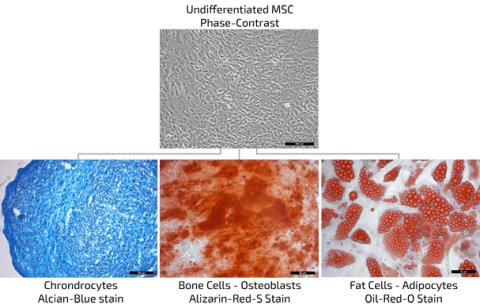 Mesenchymal Stem Cell Therapy | MSC Treatment | Anova IRM Germany