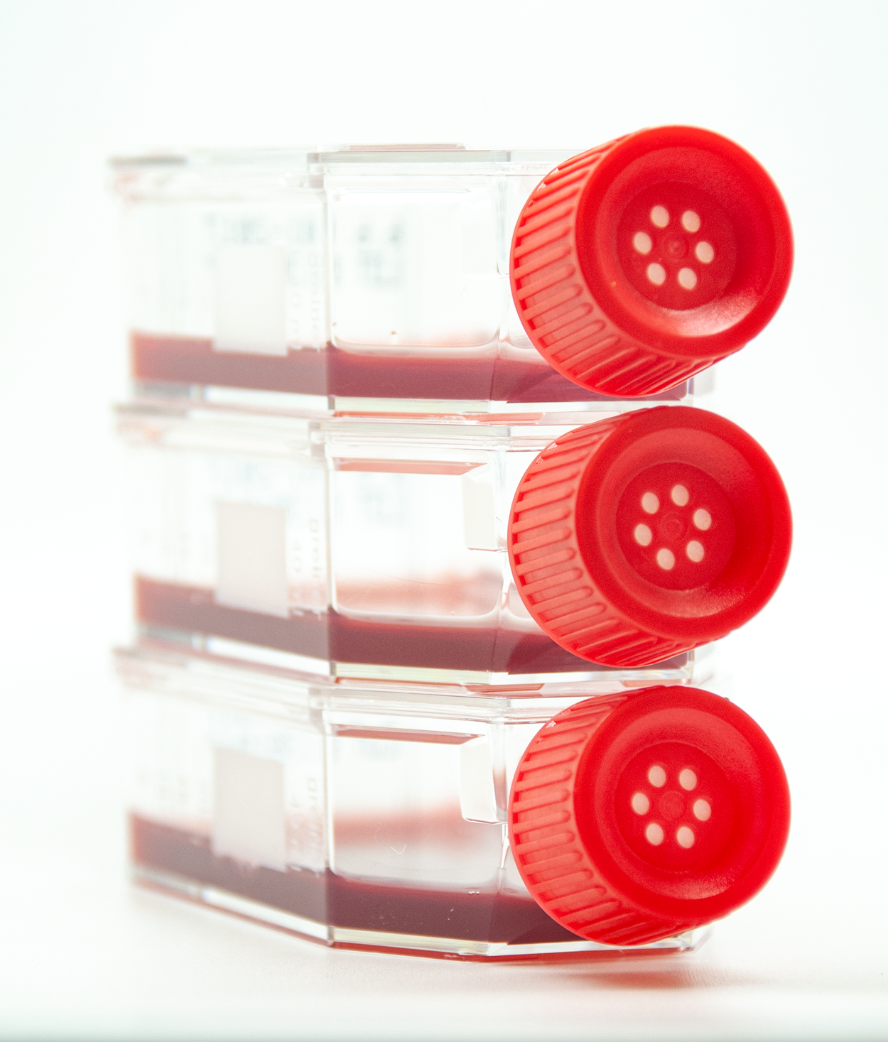 ANOVA-IRM-Deutschland-Stammzellen-Injektion-Kultivierung-Vermehrung-3-Flaschen