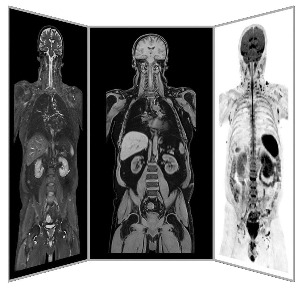 ANOVA IRM Deutschland Diagnostik MRT Schmerzen Ganzkörper Scan Siemens