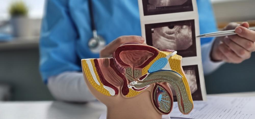 Male pelvic anatomy model used to explain erectile function during a clinical evaluation of ED symptoms.