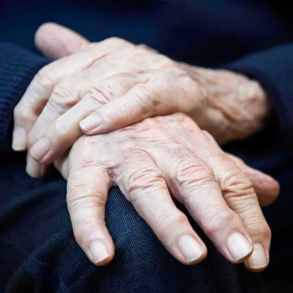 arthritis