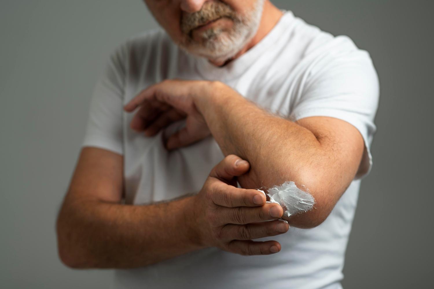 Patient applying topical medicine to the elbow to manage localized arthritis pain