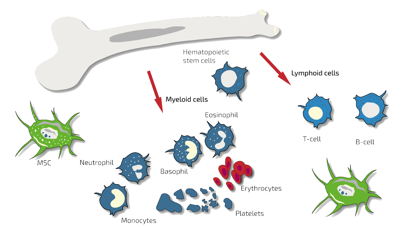 Diagram showing bone marrow aspiration, concentrate preparation and intra-articular BMC application for localized osteoarthritis treatment