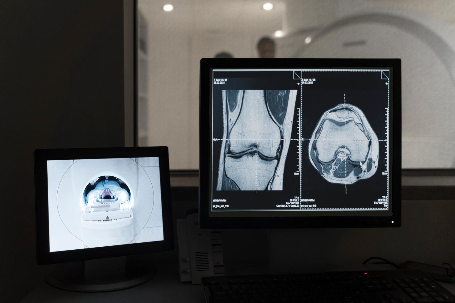 MRI imaging used for rheumatoid arthritis treatment planning and individual patient review.