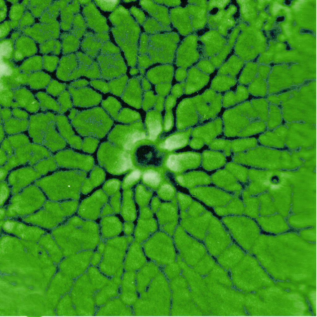 Microscopic stem cell culture image related to MSC therapy and regenerative medicine research.